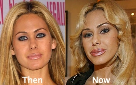 A picture of Shauna Sand before (left) and after (right).